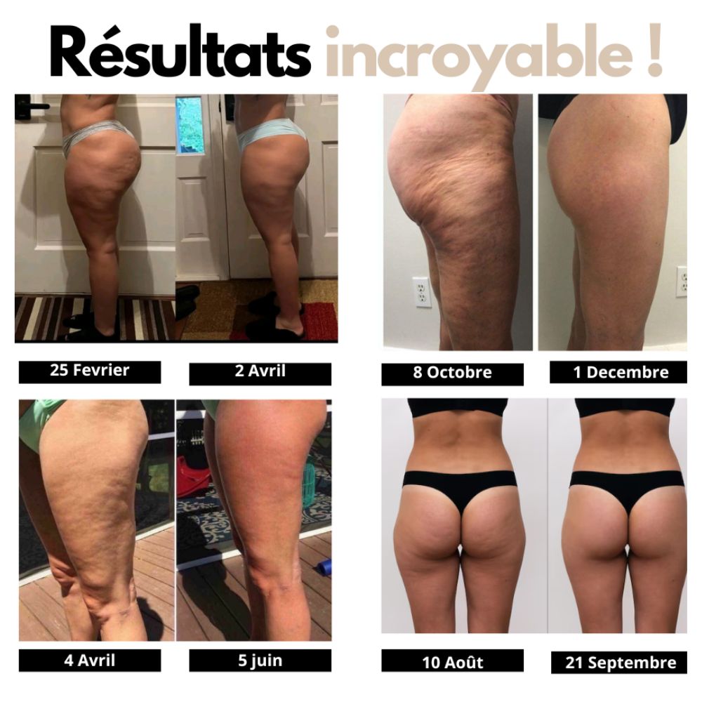 Néovira- Leggings Anti-cellulite