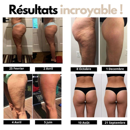 Néovira- Leggings Anti-cellulite